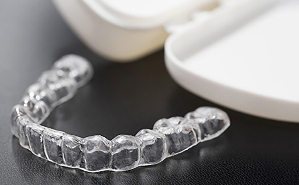 マウスピース矯正